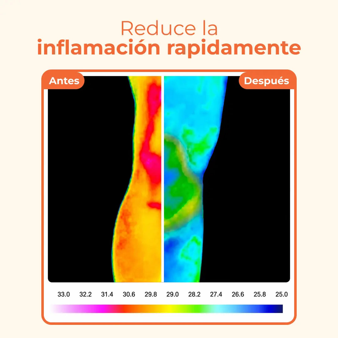 Bálsamo de Alivio Articular