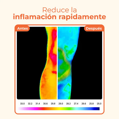Bálsamo de Alivio Articular